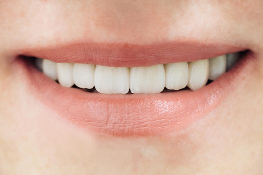 Beautiful female teeth macro zirconium. Closeup smile photo with zirconium artificial teeth. Zirconia bridge with porcelain