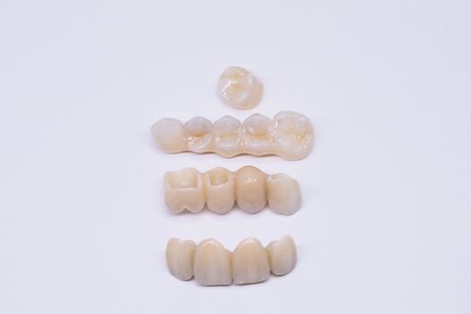 Metal free ceramic dental crowns. Long zirconia bridge with all porcelain with metal free. Beautiful ceramic teeth made in the dentist 's office.