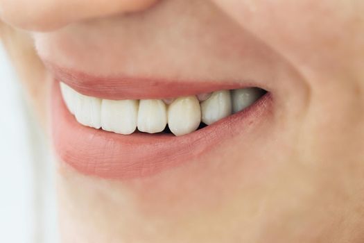 Female teeth macro zirconium. Closeup smile photo with zirconium artificial teeth. Zirconia bridge with porcelain.