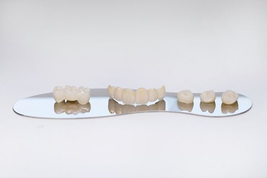 Zirconium tooth crown. Isolate on background. Aesthetic restoration of tooth loss. Ceramic zirconium in final version. Metal Free Ceramic Dental Crowns.