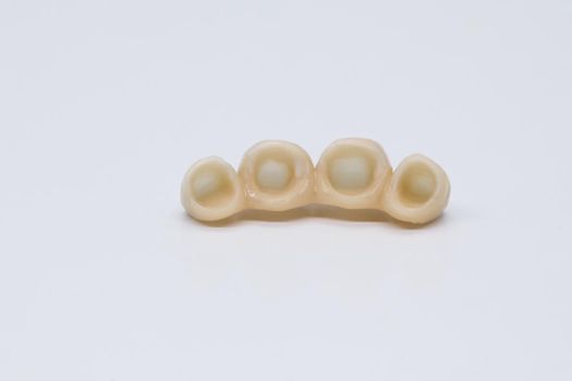 Metal free ceramic dental crowns. Dental ceramic bridge on isolated wite background.