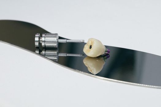 Monolithic screw retained zirconium crown on the implant, a screw and a manual key for screwing the crown.