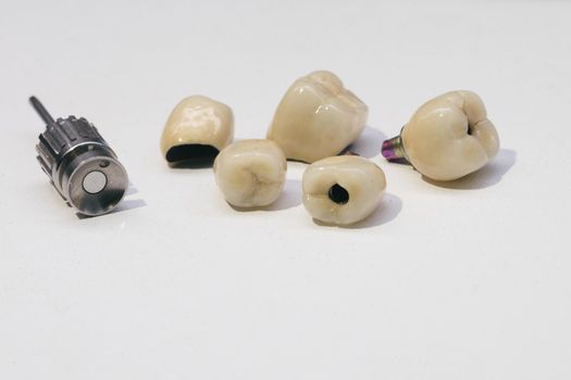 Dental zirconium crown for orthopedic screwdriver.