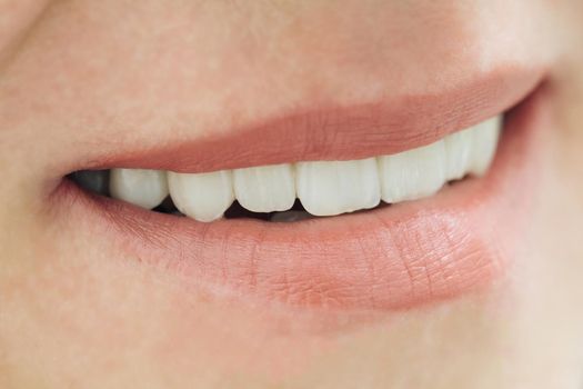 Closeup smile photo with zirconium artificial teeth. Zirconia bridge with porcelain