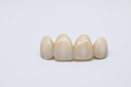 Dental ceramic bridge on isolated wite background. Metal free ceramic dental crowns