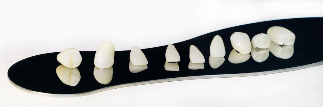 Dental health care. Dental dentist objects. Dental zirconium implants. Ceramic tooth with a totally wite background. Ceramic teeth with the veneers. Free metal ceramic teeth.