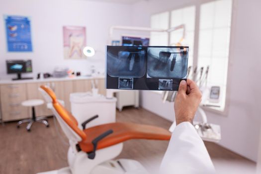 Orthodontist doctor holding medical teeth jaw radiography examining dental oral healthcare working in stomatology hospital office room. Dentistry xray professional expertise afetr tooth surgery
