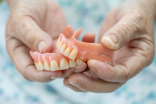 Asian senior or elderly old woman patient holding to use denture in nursing hospital ward, healthy strong medical concept