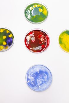Mixed of bacteria colony in petri dish standing on table in biological scientific hospital laboratory. Pharmaceutical microorganism liquid sample. Liquid medical microorganism