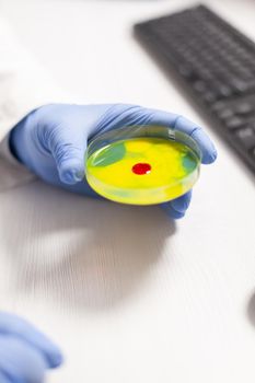 Close upf scientist holding petri dish with blood sample during vaccine research. Team of researchers examining virus evolution using high tech for vaccine development.