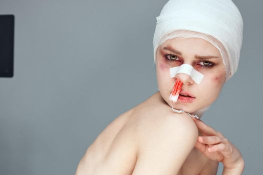 female patient tampon in the nose with blood injured face close-up. High quality photo