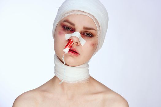 emotional woman tampon in the nose with blood injured face light background. High quality photo
