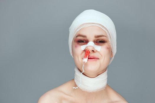 woman tampon in the nose with blood injured face isolated background. High quality photo