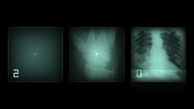 3d illustration - x-ray panels on black background