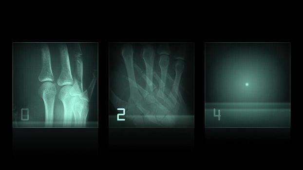 3d illustration - x-ray panels on black background