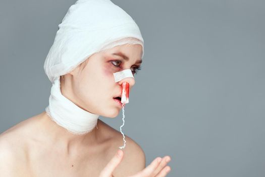 female patient plastic surgery operation bare shoulders studio lifestyle. High quality photo