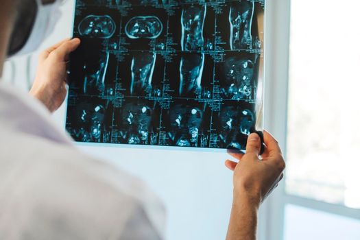 The doctor holds a picture of the human organs. X-rays of human organs in the hands of the doctor. International doctor's day. Doctor on the front line.