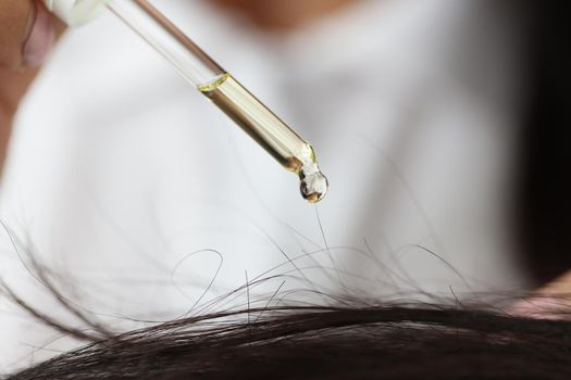 Oil drips from a pipette onto the hair on the head, close-up. Hair restoration in the salon. Cosmetic procedures against alopecia, split ends