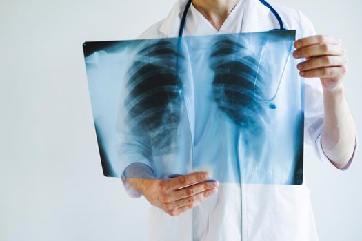 The doctor is holding an X-ray of his lungs. X-rays of a man's lungs. International doctor's day. Doctor on the front line.