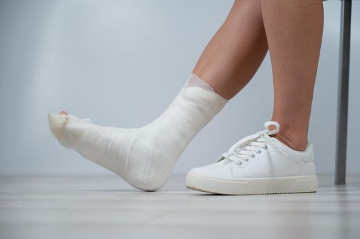 Close-up of female legs with plaster cast. A woman with a broken leg sits on a chair.