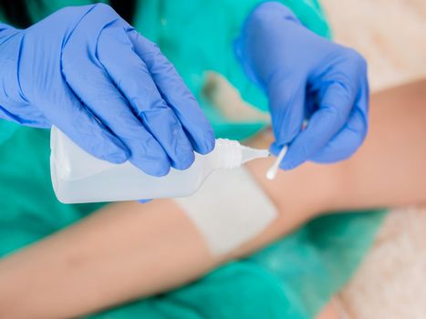 Close-up of a cotton swab and a bottle of antiseptic in the hands of a doctor, against the background of a wound on the patient's leg