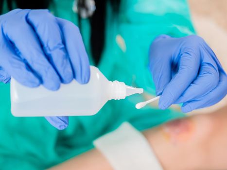 Close-up of a cotton swab and a bottle of antiseptic in the hands of a doctor, against the background of a wound on the patient's leg.