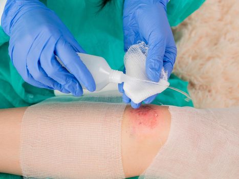 A female doctor treats an antiseptic bandage for dressing a wound on the knee of a teenage girl.