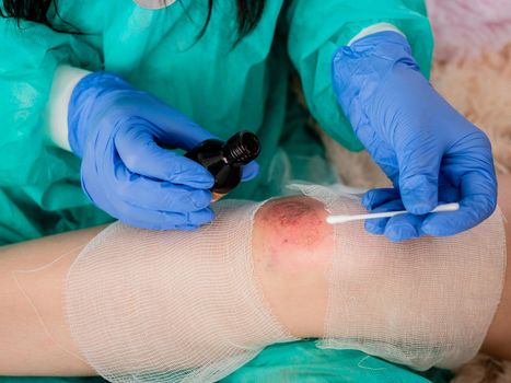 A woman treats the wound with a cotton swab soaked in iodine on the knee of a teenage girl.