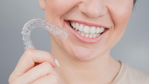 Close-up portrait of a woman putting on a transparent plastic retainer. A girl corrects a bite with the help of an orthodontic device.