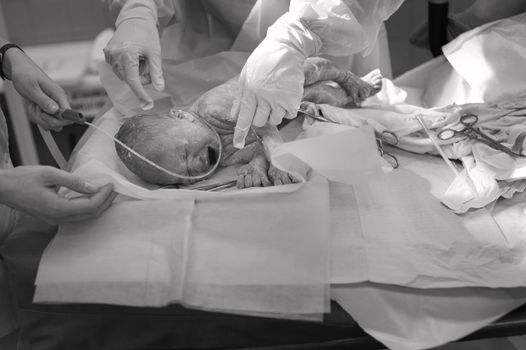 The first day of the newborn in the hospital.Black and white photo.