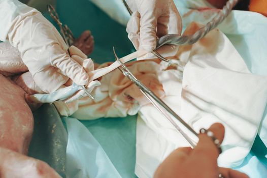 A doctor holds a new born baby whilst another doctor cuts the Umbilical cord