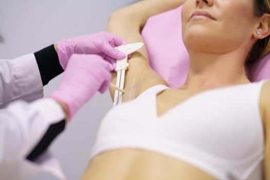 Doctor painting on the armpit of her middle-aged patient, the area to be treated for hyperhidrosis.