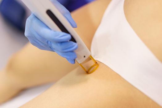 Woman receiving groins laser hair removal at a beauty center. Laser depilation treatment in an aesthetic clinic.