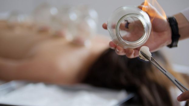 Doctor sets a medical glass cup on the back of a woman, physiotherapy, Tibetan medicine