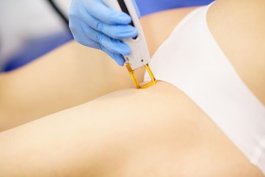 Woman receiving groins laser hair removal at a beauty center. Laser depilation treatment in an aesthetic clinic.