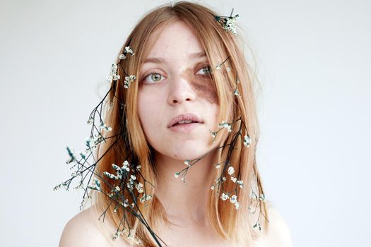 Positive young female model with brown spot on face skin and delicate flowers in hair looking up against white background