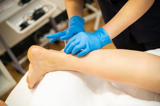 Close-up of a needle and hands of physiotherapist doing a dry needling in a physiotherapy center.