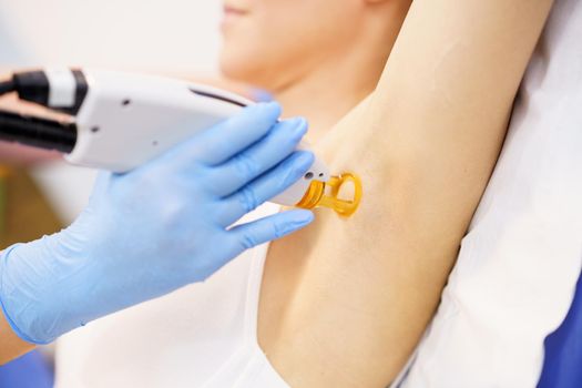 Woman receiving underarm laser hair removal at a beauty center. Laser depilation treatment in an aesthetic clinic.