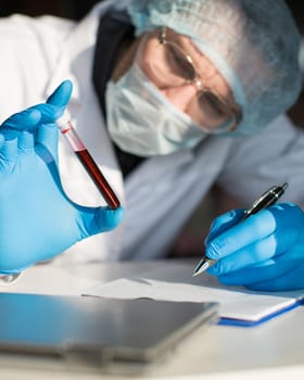 A test tube with infected blood in the hands of a doctor in the laboratory. Concept of modern research in the field of virology and immunology.