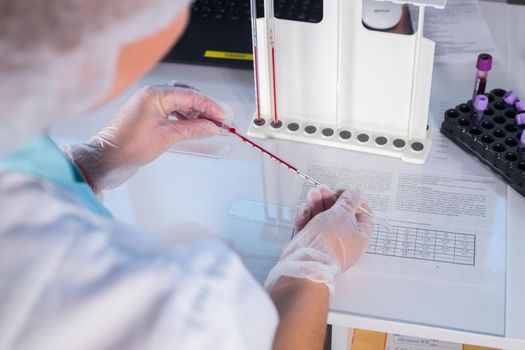 Medical clinic. Nurse at her workplace. A pipette filled up with blood. Close up