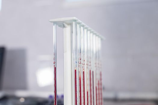 Medical clinic. A stand with pipettes filled with blood. Close up shot