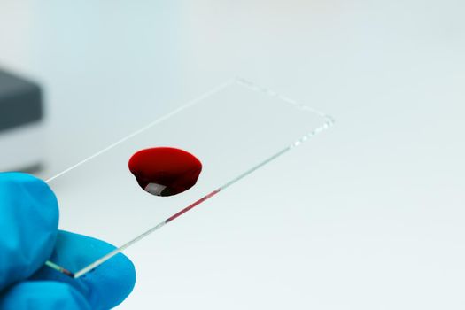 Laboratory glass slide with drop of blood close up. Medical test concept