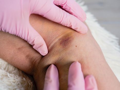 Close-up of physiotherapist treating knee after injury