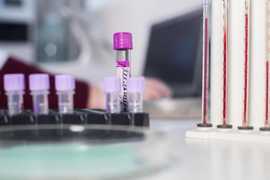 Medical clinic. A stand with pipettes filled with blood standing near the sample tubes. Tube close up shot