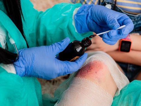 Close-up of treatment with antiseptic and iodine wounds on the knee