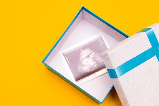 ultrasound picture in a silver box with a blue ribbon and yellow flower yellow background place copy top view, woman pregnant with boy or girl, surprise, photo as a gift, pregnancy concept