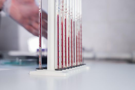 Medical clinic. A stand with pipettes filled with different blood. Close up