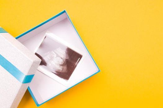 ultrasound picture in a silver box with a blue ribbon and yellow flower yellow background place copy top view, woman pregnant with boy or girl, surprise, photo as a gift, pregnancy concept