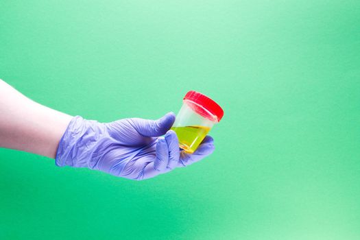 hand in a disposable medical glove holds a jar for analysis with urine, green background, copy space