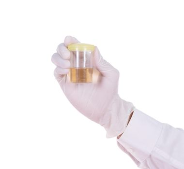 doctor's hand in gloves holding a transparent container with the analysis of urine isolated on white background